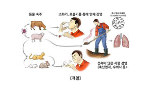 큐열 유행 (사진=서울아산병원 제공, 연합뉴스)