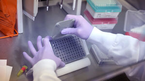 "조류독감, 사람 간 전염 가능해지면 코로나보다 심한 팬데믹"