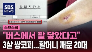 [스브스픽] "버스에서 팔 닿았다고&hellip;" 3살 아이 무차별 폭행한 20대 여성