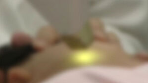 25만 원 받고 사마귀 제거…불법 시술한 미용업자 집행유예