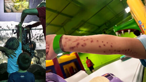 수족관서 문어에 팔 잡힌 6살 아이…멍자국 가득 '봉변'