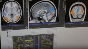 '치매 쥐에 이것 투여했더니…' 하버드 논문 나오자 발칵