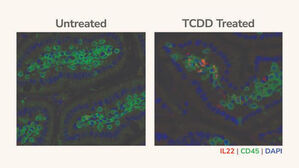 "담배 속 화학물질, 면역세포와 결합해 췌장암 위험 높인다"