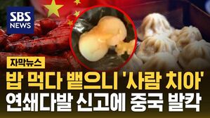 (수정) 자막뉴스 중국 음식 속 치아