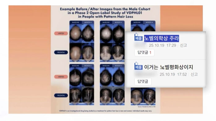 "노벨상 줘라" 탈모약 뜨거운 반응…확인해 보니 [사실은]