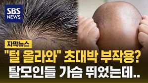 [자막뉴스] "몸에 털 올라와" 초대박 부작용? 탈모인들 가슴 뛰었는데..