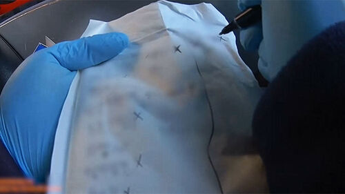 "어쩌나" 뺑뺑이 여전…"방지법 무용지물" 의사들 부글