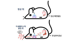공기 흡입 미세플라스틱, 대장 이동 변비 유발 가능성