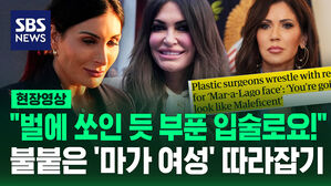 [현장영상] "볼 더 빵빵하게!" "입술은 벌이 쏜 것처럼!" 워싱턴서 요청 쇄도한 '마가 성형' 뭐길래?