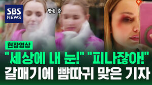 [현장영상] "피가 나고 있어!" "저요?" 촬영 중 돌진한 갈매기에 경악