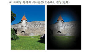 "베개 없이 자는 자세, 녹내장 환자 안압 상승 낮출 수 있어"