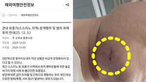 [빅토픽] 한국인 일본서 집단폭행&hellip;앞니 3개 부러져