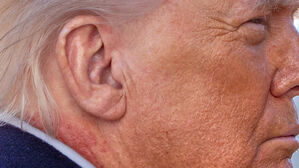 트럼프 목에 붉은 반점&hellip;백악관 "사용하는 연고 탓" 해명