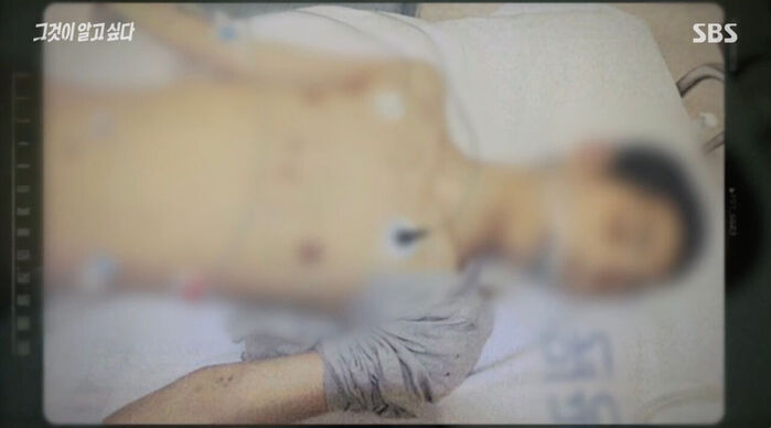 "안 때리면 내가 죽어"&hellip;계부 학대 속 친모는 방관, 결국