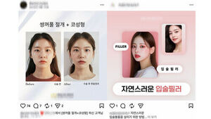 "시술하고 정말 예뻐졌어요"&hellip;알고보니 AI 생성 가짜 후기