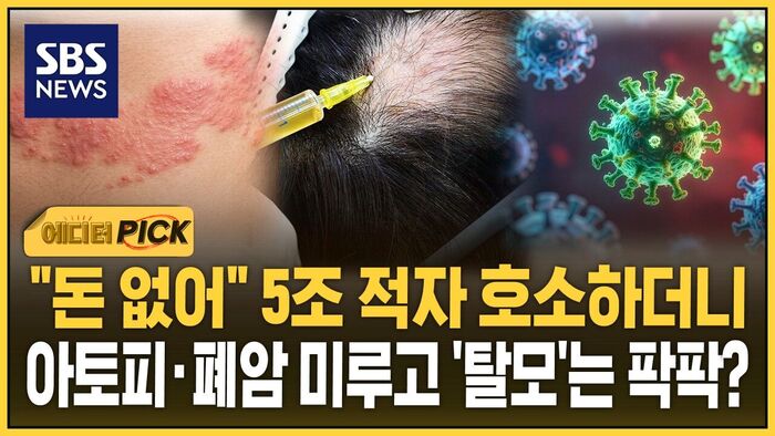 "돈 없어" 5조 적자 호소하더니..아토피·폐암 미루고 '탈모'는 팍팍?