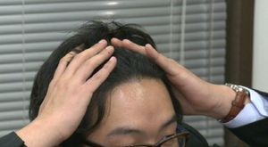 '탈모 원인' 밝혀졌다