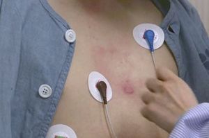 미국 부정맥 환자 급증&hellip;"40대 이상 4명에 1명꼴"