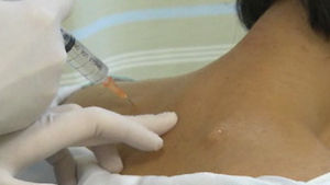 만성통증 환자 220만 명&hellip;방치하면 뇌에 손상