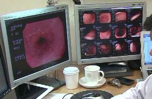일부 병원, 대장내시경에 사용 금지 장 세척제 처방