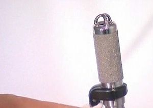 11g 초미니 인공 심장, 16개월 아기에게 이식
