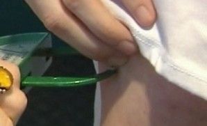 [건강] "지방부족, 여성 불임 원인"