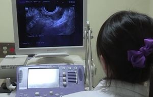 [건강] 난소암, 수술 통해 극복 가능