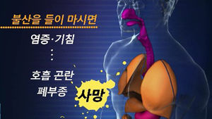 뭐든지 녹인다는 불산, 인체에 끼치는 영향은?