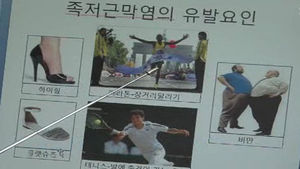 [건강] 무리한 걷기 운동, 족저근막염 위험