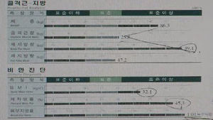 [건강] 비만, 체내 독소 제거로 개선 가능