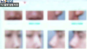 "성형 광고에 내 얼굴이"&hellip;항의해도 협박&middot;무시