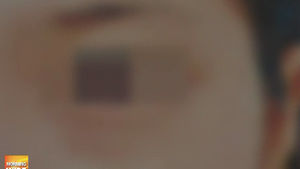 '수술 전후 얼굴' 제멋대로 광고&hellip;항의해도 배짱