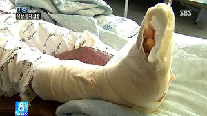 낙상 환자 20배 급증&hellip;다친 부위 방치 시 낭패