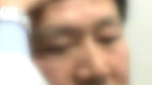 [건강] 졸려보이고 두통까지&hellip;눈꺼풀 처짐증