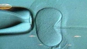 美 연구팀, 인간 배아줄기 세포 복제 첫 성공