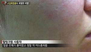 [취재파일] "화장품, 안전 안하면 말고?" 식약처의 두 얼굴