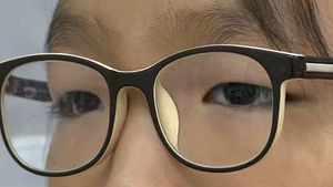[건강] 간헐성 외사시 방치하면 시력 손상 가능성
