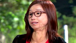 이지선 "나는 연예인이다"&hellip;남다른 긍정의 힘에 감동