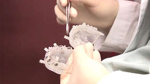 [건강] 고혈압&middot;당뇨 환자에게도 가능한 '정밀 시술 임플란트'