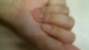 中 항저우 유치원생 집단으로 손톱 빠져&hellip;공포 확산
