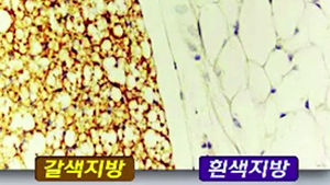 [메디컬리포트] 자꾸 살 찌는 이유&hellip;갈색지방 때문?