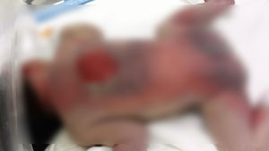 [현장 포토] 병원서 중화상 입은 신생아