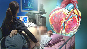 돌연사 일으키는 '심부전증'&hellip;중년 남성 급증