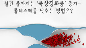 [인포그래픽] 뇌졸중 부르는 '죽상경화증' 급증&hellip;예방법은?