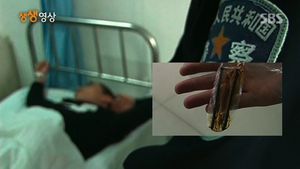 [생생영상] 일부러 10cm 대못 삼킨 남성&hellip;황당한 좀도둑