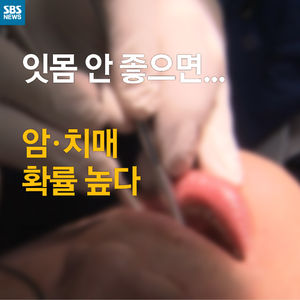 [카드 뉴스] 이 잘 안닦으면&hellip;암&middot;치매 확률↑