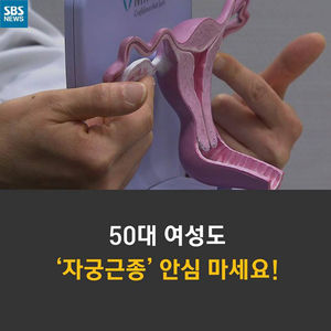 [카드뉴스] 자궁 속 종양 '자궁근종'&hellip;50대도 안심 마세요!