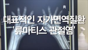 [닥터스] 나무토막처럼 굳은 몸&hellip;류마티스 관절염 공포