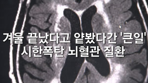 [닥터스] 겨울 끝나간다고 얕봤다간 '큰일'&hellip;'시한폭탄' 뇌혈관 질환