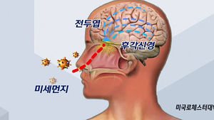 초미세먼지 공포&hellip;"뇌에 침투해 치매 위험 높인다"
